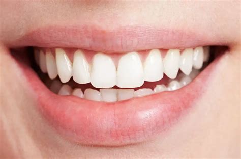 Say goodbye to yellow teeth: natural tooth brightening secrets revealed